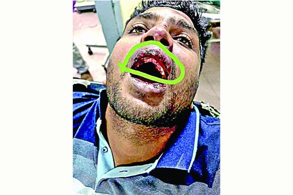 এডিসি হারুনে তোলপাড় ছাত্রলীগের দুই নেতাকে নির্মম নির্যাতন, করা হলো বদলি