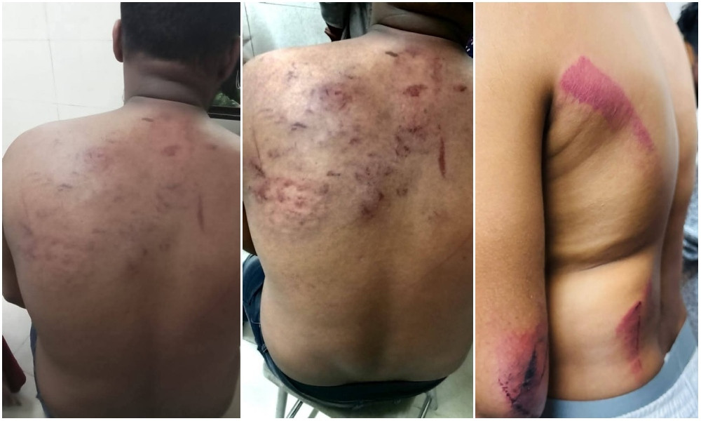 মিরপুরে জাতীয় নাগরিক পার্টির কর্মীদের ওপর হামলা, বিক্ষোভ