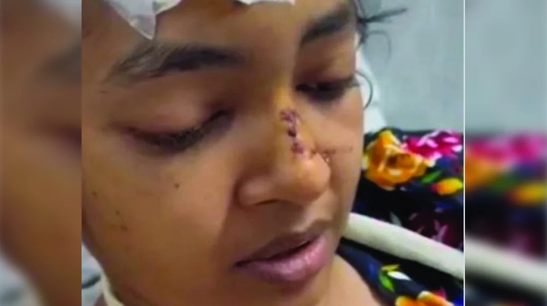 ‘চেয়ারম্যান ডিক্লার দিছে, একবারেই মাইরা ফালা, ২০টা মামলা অইলে অইব’